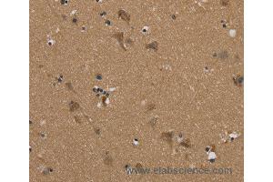 Immunohistochemistry of Human brain  using PUS10 Polyclonal Antibody at dilution of 1:45 (PUS10 antibody)