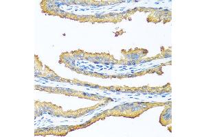 Immunohistochemistry of paraffin-embedded human prostate using TAC1 antibody at dilution of 1:100 (40x lens). (TAC1 antibody)