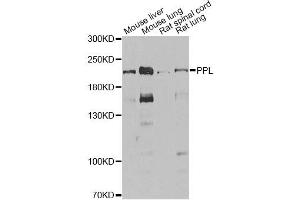 Western blot analysis of extracts of various cell lines, using PPL antibody.