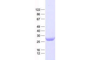 Validation with Western Blot (ATG101 Protein (His tag))