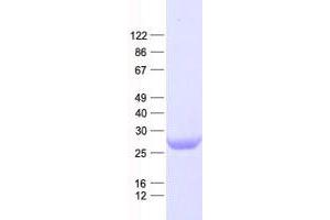 ATG101 Protein (His tag)