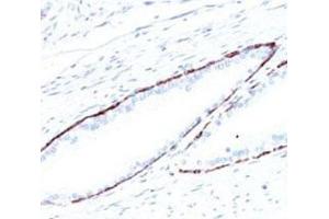 Immunohistochemical staining (Formalin-fixed paraffin-embedded sections) analysis of human prostate with Cytokeratin, HMW monoclonal antibody, clone 34bE12 . (Cytokeratin 1 antibody)