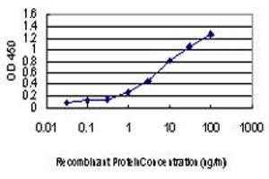 Detection limit for recombinant GST tagged CDKL1 is approximately 0. (CDKL1 antibody  (AA 259-358))