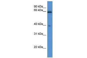 Western Blot showing Asrgl1 antibody used at a concentration of 1-2 ug/ml to detect its target protein. (ASRGL1 antibody  (C-Term))
