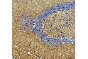 IHC analysis of Synapsin II using anti-Synapsin II antibody (ABIN4886735). (SYN2 antibody  (AA 497-582))