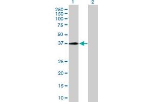 Western Blot analysis of HSD17B2 expression in transfected 293T cell line by HSD17B2 MaxPab polyclonal antibody. (HSD17B2 antibody  (AA 1-387))