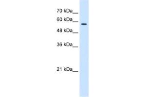 Western Blotting (WB) image for anti-Chaperonin Containing TCP1, Subunit 8 (Theta) (CCT8) antibody (ABIN2462906) (CCT8 antibody)