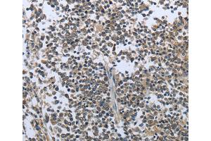 Immunohistochemistry (IHC) image for anti-Prolactin (PRL) antibody (ABIN5543735) (Prolactin antibody)