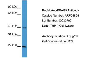 Western Blotting (WB) image for anti-Estrogen Receptor Binding Site Associated, Antigen, 9 (EBAG9) (C-Term) antibody (ABIN2788244)