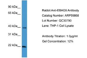 WB Suggested Anti-EBAG9  Antibody Titration: 0. (RCAS1 antibody  (C-Term))