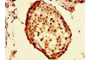 Immunohistochemistry of paraffin-embedded human testis tissue using ABIN7152582 at dilution of 1:100 (FAF1 antibody  (AA 490-629))