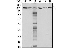 Western blot analysis using CDH1 mouse mAb against LNCAP (1),A431 (2), DU145 (3), PC-3 (4), PC-12 (5) and T47D(6) cell lysate. (E-cadherin antibody)