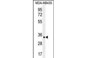 ALKBH6 Antibody (Center) (ABIN655230 and ABIN2844835) western blot analysis in MDA-M cell line lysates (35 μg/lane). (ALKBH6 antibody  (AA 116-145))