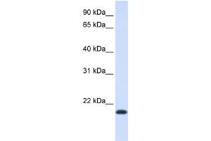 WB Suggested Anti-NKAIN1 Antibody Titration:  0.