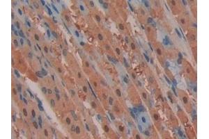 Immunohistochemistry (IHC) image for anti-Mitogen-Activated Protein Kinase Kinase 2 (MAP2K2) (AA 44-313) antibody (ABIN7439504)