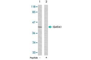 Western blot analysis of extracts from K-562 cells using GATA1 polyclonal antibody . (GATA1 antibody  (Ser142))