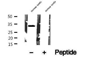 Western blot analysis of extracts of mouse testis tissue, using Syntaxin 17 antibody. (Syntaxin 17 antibody  (C-Term))