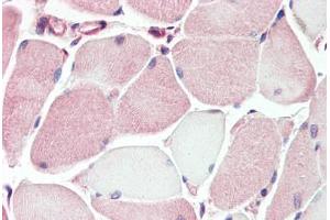 Human Skeletal Muscle (formalin-fixed, paraffin-embedded) stained with XK antibody ABIN462089 followed by biotinylated goat anti-rabbit IgG secondary antibody ABIN481713, alkaline phosphatase-streptavidin and chromogen. (Membrane transport protein XK (XK) (AA 22-38) antibody)