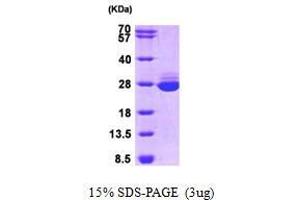 Figure annotation denotes ug of protein loaded and % gel used. (GSTA1 Protein (AA 1-222))