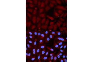 Immunofluorescence analysis of U2OS cell using SFTPC antibody. (Surfactant Protein C antibody  (AA 1-197))