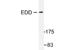 Image no. 1 for anti-Ubiquitin Protein Ligase E3 Component N-Recognin 5 (UBR5) antibody (ABIN271946) (UBR5 antibody)