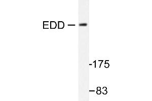Image no. 1 for anti-Ubiquitin Protein Ligase E3 Component N-Recognin 5 (UBR5) antibody (ABIN271946)