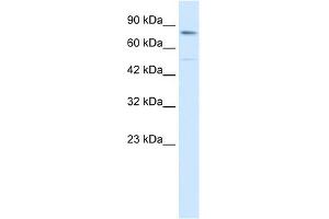 WB Suggested Anti-ZNF341 Antibody Titration: 0. (ZNF341 antibody  (Middle Region))