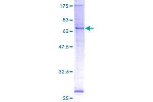 SDS-PAGE (SDS) image for Porcupine Homolog (PORCN) (AA 1-456) protein (GST tag) (ABIN1798129) (PORCN Protein (AA 1-456) (GST tag))