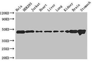 ASCC1 antibody  (AA 1-315)