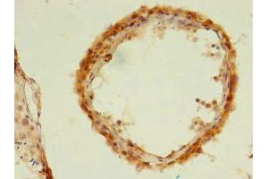 Immunohistochemistry of paraffin-embedded human testis tissue using ABIN7174516 at dilution of 1:100 (UBLCP1 antibody  (AA 2-318))