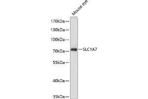 Western blot analysis of extracts of mouse eye, using SLC1 antibody (ABIN6129470, ABIN6147878, ABIN6147879 and ABIN6214419) at 1:1000 dilution. (SLC1A7 antibody  (AA 115-220))