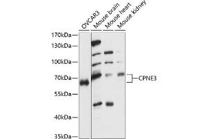 Western blot analysis of extracts of various cell lines, using CPNE3 antibody (ABIN7266500) at 1:1000 dilution.