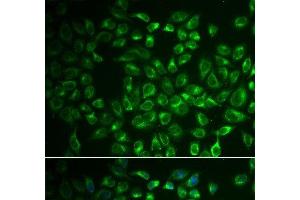 Immunofluorescence analysis of A549 cells using FABP6 Polyclonal Antibody (FABP6 antibody)