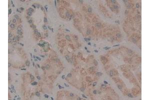 DAB staining on IHC-P; Samples: Human Kidney Tissue (WNT2 antibody  (AA 26-360))