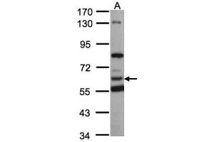 WB Image Sample(30 ug whole cell lysate) A:293T 7. (HACL1 antibody  (C-Term))