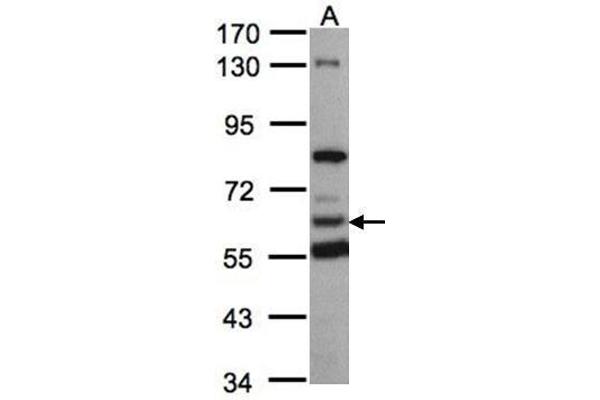 HACL1 antibody  (C-Term)