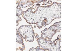 Immunohistochemistry (Paraffin-embedded Sections) (IHC (p)) image for anti-CD59 (CD59) (AA 74-110) antibody (ABIN6242239)