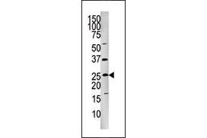 Image no. 1 for anti-Fas (TNFRSF6)-Associated Via Death Domain (FADD) (pSer191) antibody (ABIN358126) (FADD antibody  (pSer191))