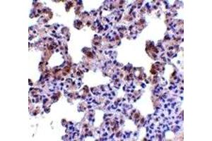 Immunohistochemistry (IHC) image for anti-Presenilin Enhancer 2 Homolog (PSENEN) (N-Term) antibody (ABIN1031508)