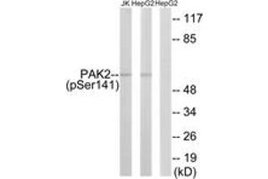 Western blot analysis of extracts from HepG2 cells treated with Adriamycin 0. (PAK2 antibody  (pSer141))