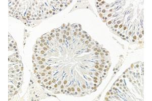 anti-Ataxin 7-Like 1 (ATXN7L1) (Internal Region) antibody