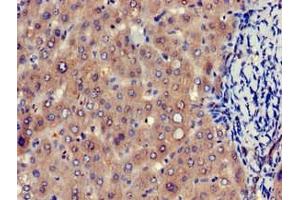 Immunohistochemistry of paraffin-embedded human liver tissue using ABIN7152188 at dilution of 1:100 (EIF4ENIF1 antibody  (AA 340-630))