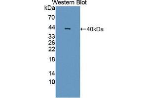 Figure. (MYBPC1 antibody  (AA 1-277))