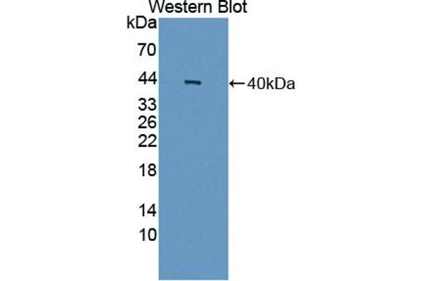 MYBPC1 Antikörper  (AA 1-277)
