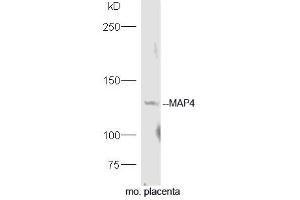 Mouse placenta lysates probed with Rabbit Anti-MAP4 Polyclonal Antibody, Unconjugated (ABIN754243) at 1:300 overnight at 4˚C.