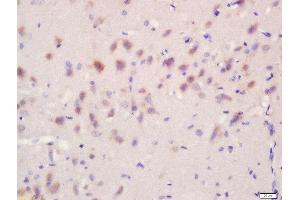 Formalin-fixed and paraffin embedded rat brain tissue labeled with Anti-Regucalcin/SMP30 Polyclonal Antibody, Unconjugated  at 1:200 followed by conjugation to the secondary antibody and DAB stainin