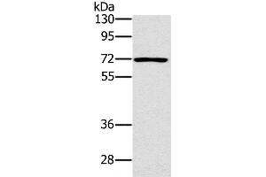 Western Blot analysis of Raji cell using PLS3 Polyclonal Antibody at dilution of 1:400 (Plastin 3 antibody)