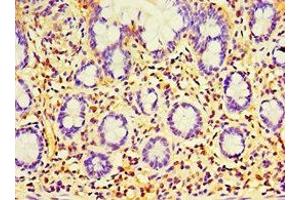 Immunohistochemistry of paraffin-embedded human small intestine tissue using ABIN7168365 at dilution of 1:100 (EWSR1 antibody  (AA 1-300))