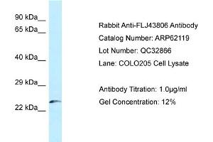 Western Blotting (WB) image for anti-Kazrin (KAZ) (N-Term) antibody (ABIN2781340) (Kazrin antibody  (N-Term))