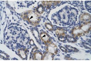 Human kidney; TRIM68 antibody - middle region in Human kidney cells using Immunohistochemistry (TRIM68 antibody  (Middle Region))